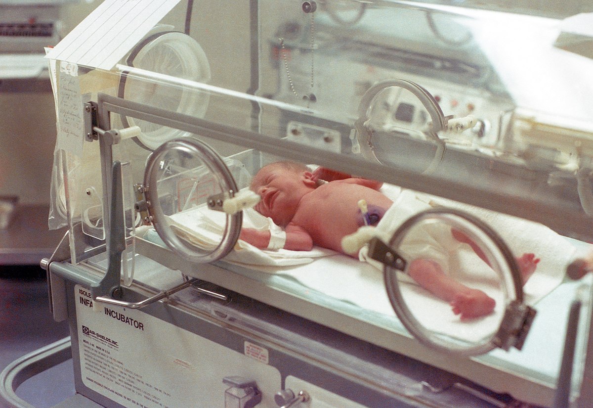 premature baby in incubator