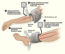 blunt trauma wikipedia