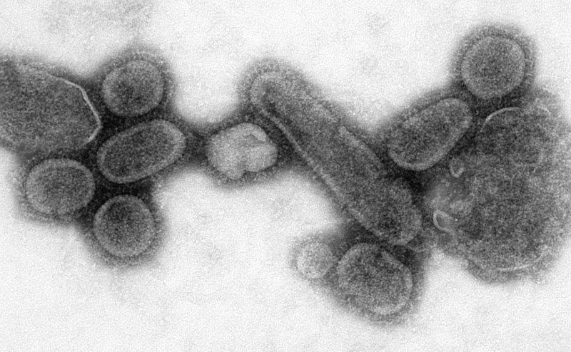 Reconstrucción del virus de la pandemia de gripe de 1918 que llegó a matar a cerca del 5 % de la población humana entre 1918 y 1919. Es considerada la más grave pandemia en toda la historia de la humanidad.