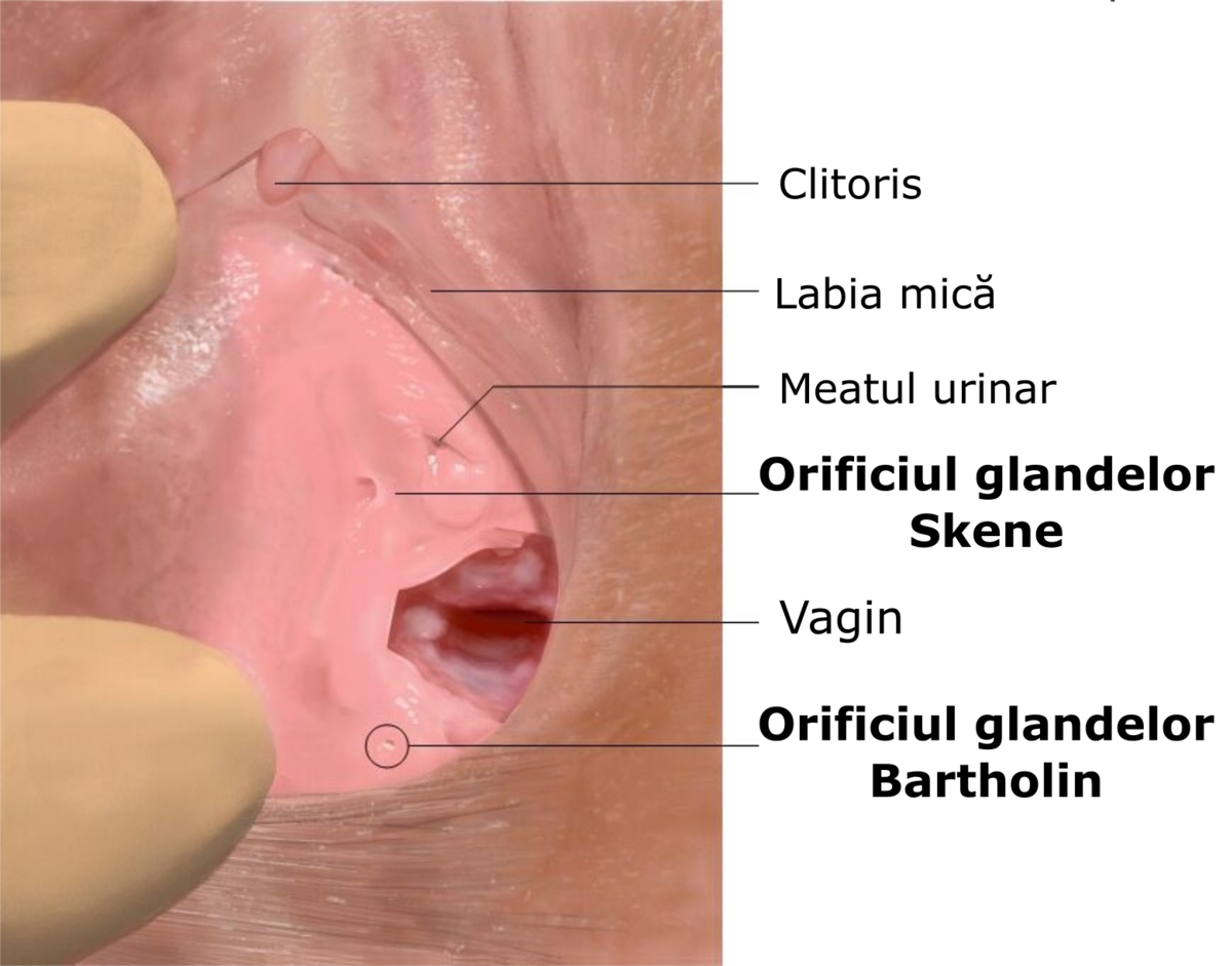 chist bartholin