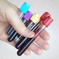 Vacutainer blood bottle.jpg