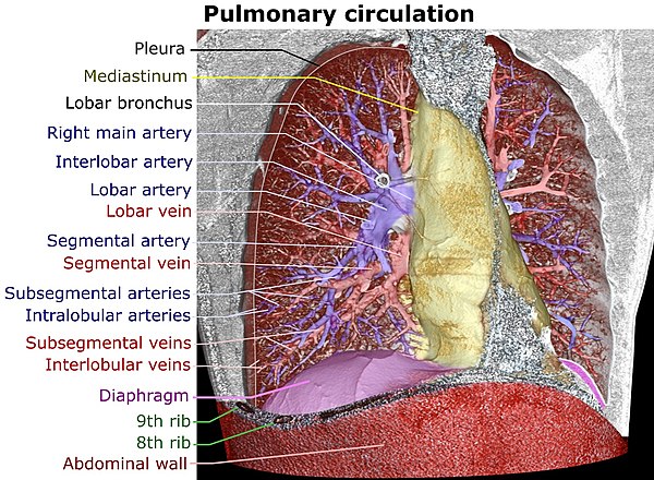 Volume rendering of a high resolution computed tomography of the thorax. The anterior thoracic wall, the airways and the pulmonary vessels anterior to