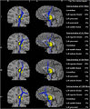 Thumbnail for version as of 20:40, 10 November 2015