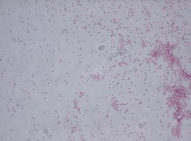 Enterobacter aerogenes.jpg