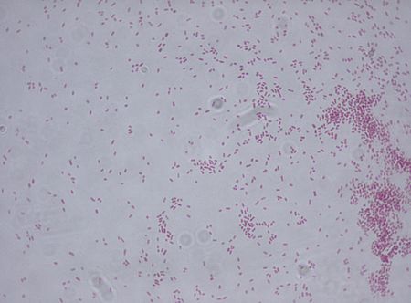 Enterobacter aerogenes.jpg