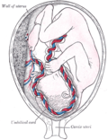 Thumbnail for Percutaneous umbilical cord blood sampling