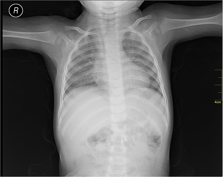 File:Medical X-Ray imaging POB06 nevit.jpg