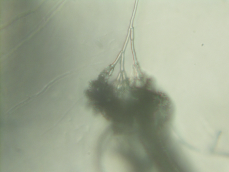 File:Penicillium conidiophore 160X.png