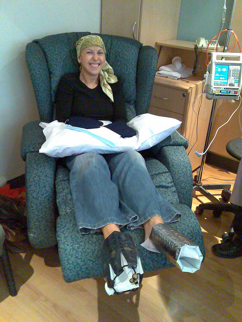 Chemotherapy - Wikipedia