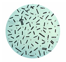 Генцианвиолет менән буялған Clostridium botulinum препараты фотографияһы