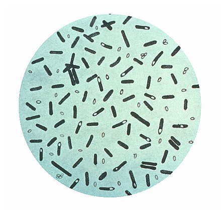 A photomicrograph of Clostridium botulinum bacteria
