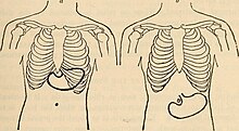 Diseases of infancy and childhood (1914) (14585483937).jpg