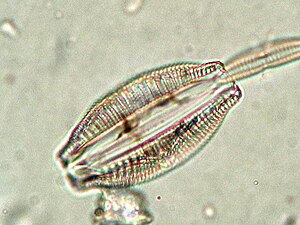 Epithemia sorex, girdle view