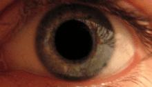 Eye dilate-thumb 300px.gif