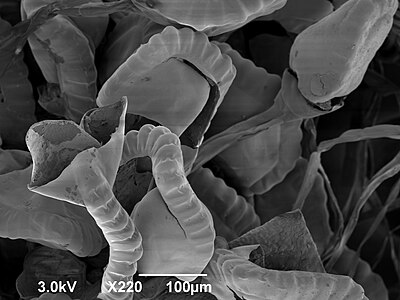 Sporendoosjes of sporangia met annuli (de wormvormige structuren)
