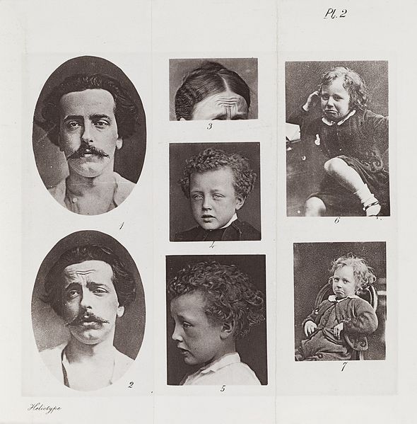 File:Grief, from Darwin's Expressions of Emotions in Man..... Wellcome L0049517.jpg