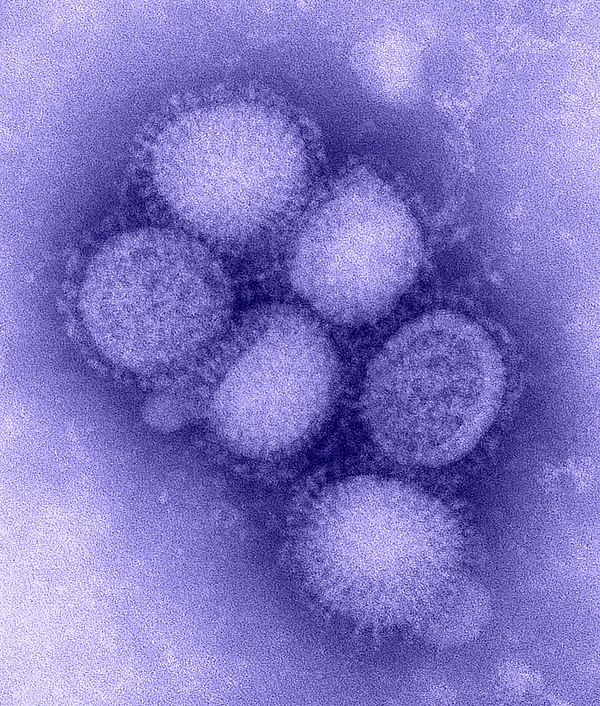 Influenza A virus subtype H1N1