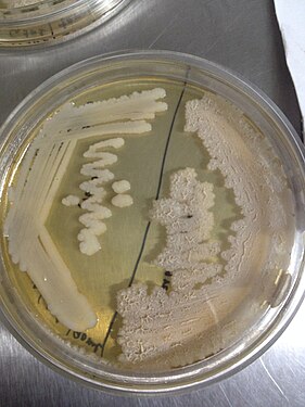 Microbial culture:1st half staph 2nd half L.monocytogenes