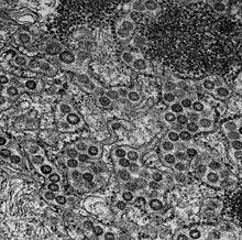 MRC-5 cell MERS Coronavirus Particles (14702511068).jpg