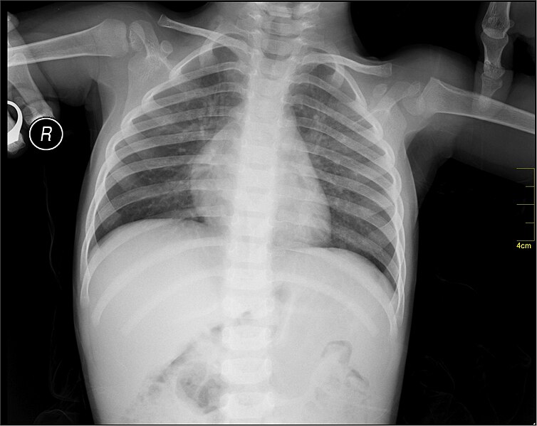 File:Medical X-Ray imaging BEC02 nevit.jpg