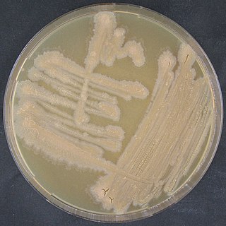 <i>Tsukamurella tyrosinosolvens</i> Species of bacterium