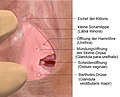 Scheidenvorhof (Vestibulum vaginae) mit Mündungsöffnungen der verschiedenen Drüsen