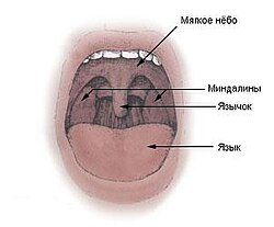 Увулопалатопластика