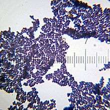 Unknown variety of Staphylococcus, Gram-stained - numbered ticks on the scale are 11 um apart 20101017 231210 Staphylococcus.jpg