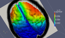 Image-guided neurosurgery, brain deformation simulation Advanced Simulation Library - Image-guided neurosurgery, brain deformation simulation.png