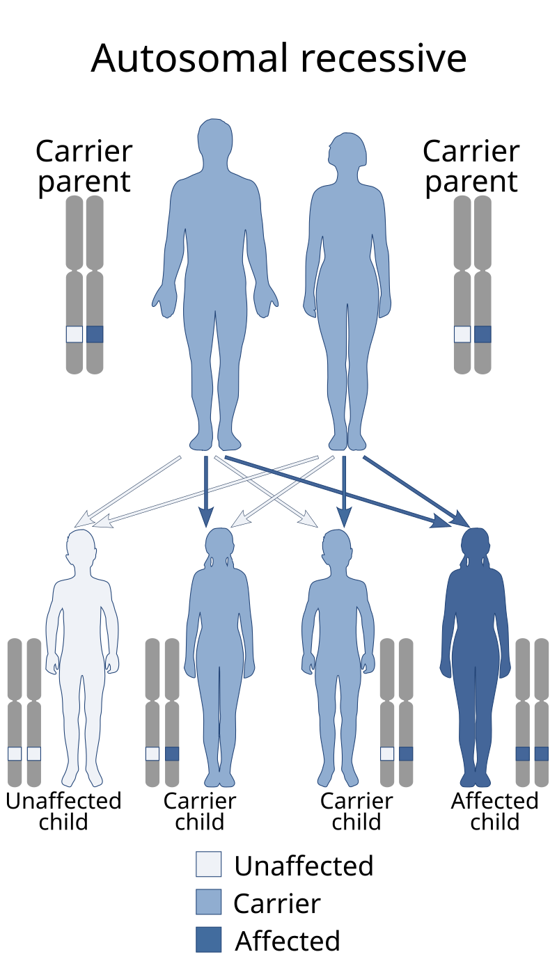 Donnai Barrow syndrome Wikipedia