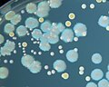 Bacteria on agar plate.jpg