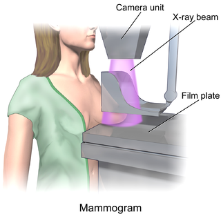 <span class="mw-page-title-main">Breast imaging</span>