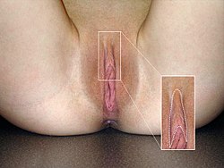 Clitoris hood prepuce pics
