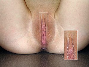 Předkožka Klitorisu: Vývoj a typy, Stimulace, Modifikace