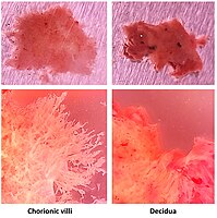 Chorionvilli en decidua