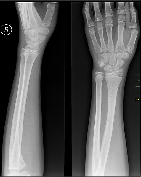 File:Medical X-Ray imaging RAT06 nevit.jpg