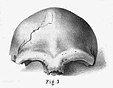 Schädeldach von Neandertal 1