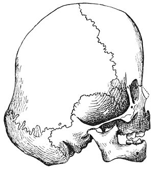 PSM V39 D553 Right lateral aspect of the navajo child skull.jpg