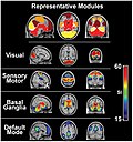 Thumbnail for Sensory nervous system