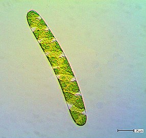 Spirotaenia, a genus of basal green algae that may be sister to the Chlorokybophyceae