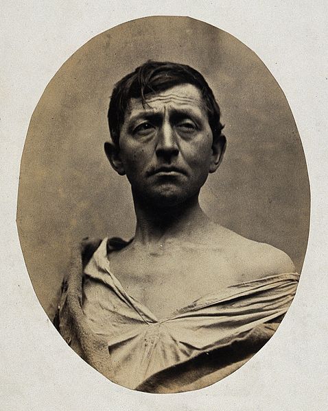 File:A man, head and shoulders; his shirt undone. Photograph by L Wellcome V0029460.jpg