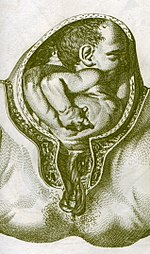 Cordón umbilical - Wikipedia, la enciclopedia libre