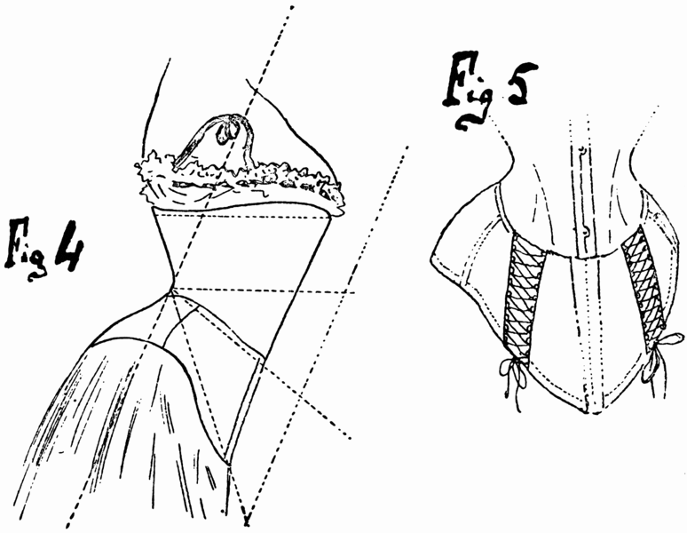 File:Corset a membrane abdominale.gif