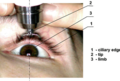Diaton tonometar za mjerenje očnog tlaka preko vjeđe i bez dodira s očnom jabučicom