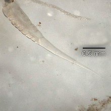 parazita pinworm körömféregben emésztetlen élelmiszer törmelék ürül ki
