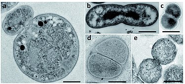 Transmission electron micrographs of dividing cells displaying different cell division modes in the PVC superphylum. (a) Gemmata obscuriglobus (b) Chthoniobacter flavus (c) Lentisphaera araneosa (d) Phycisphaera mikurensis and (e) Chlamydia trachomatis. Scale bars, 0.5 mm. Fmicb-07-01964-g002 (1).jpg