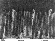 Cells lining the small intestine increase the surface area over which they can absorb nutrients with a carpet of tuftlike microvilli. Human jejunum microvilli 2 - TEM.jpg