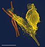 Hình ảnh kính hiển vi điện tử quét của một bạch cầu trung tính (màu vàng) đang nuốt vi khuẩn bệnh than (màu cam).