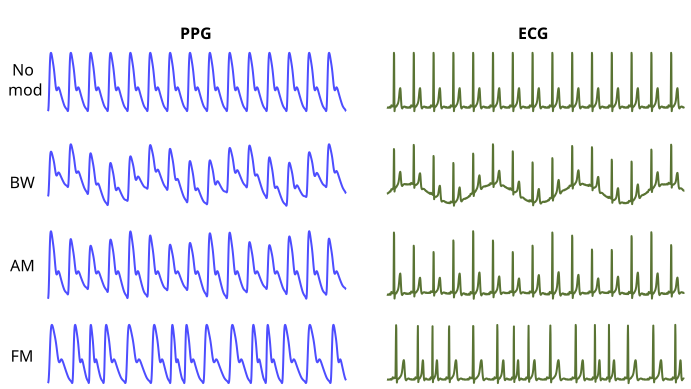 File:Respiratory modulations of photoplethysmogram and electrocardiogram signals.svg