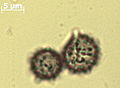 Russula foetens (spore) mo76143.jpg